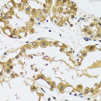 Immunohistochemistry - RPS12 antibody (144-05890)