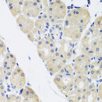 Immunohistochemistry - ALAD Polyclonal Antibody (144-08398)