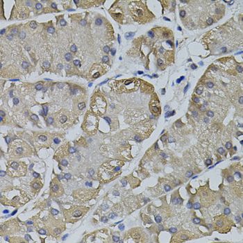 Immunohistochemistry - TRPC3 antibody (144-07742)