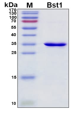 SDS-PAGE Image