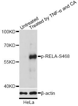 Western blot - Phospho-RELA-S468 antibody (144-61496)