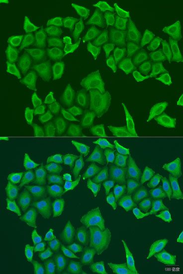 Immunofluorescence - HAUS8 antibody (144-07847)