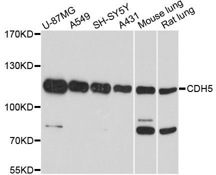 Western blot - CDH5 Polyclonal Antibody (144-00734)