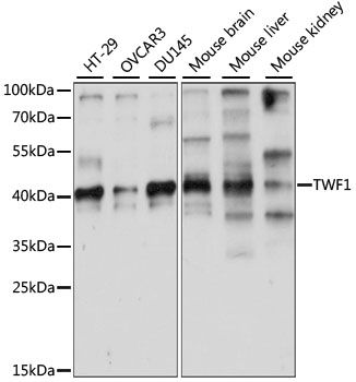 Western blot
