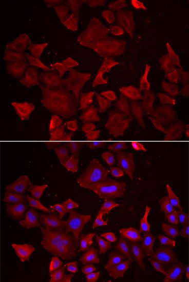 Immunofluorescence - CASP14 Polyclonal Antibody (144-06541)