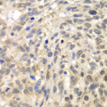 Immunohistochemistry - TLK2 antibody (144-06770)
