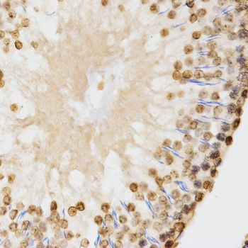Immunohistochemistry - DiMethyl-Histone H3-K9 antibody (144-02359)