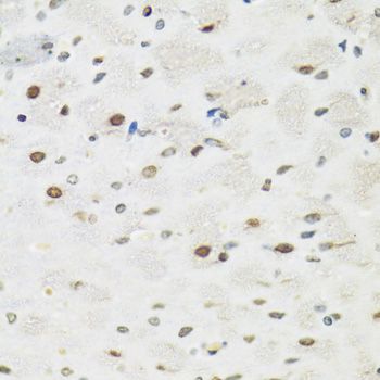 Western blot - SFPQ Polyclonal Antibody (144-00958)