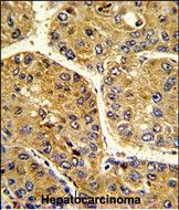 IHC-P