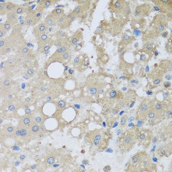 Immunohistochemistry - CHMP1B antibody (144-08239)