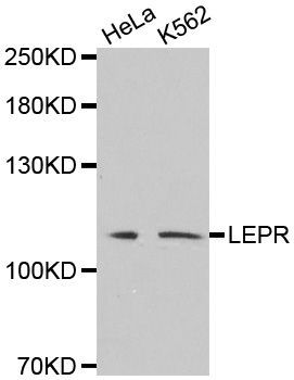 Western blot - LEPR Polyclonal Antibody (144-02999)