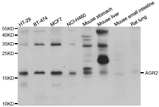 Western blot - AGR2 antibody (144-07064)
