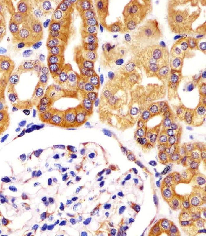 IHC-P