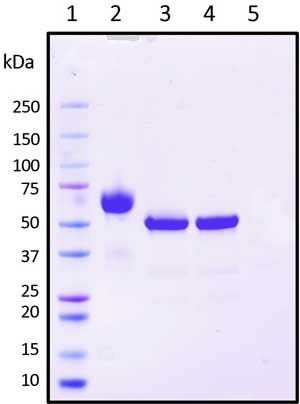 SDS-PAGE