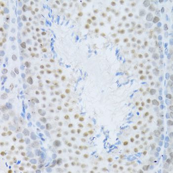 Immunohistochemistry - MAPK3 Polyclonal Antibody (144-00228)
