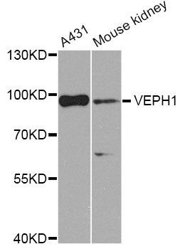 Western blot - VEPH1 Antibody (144-08510)