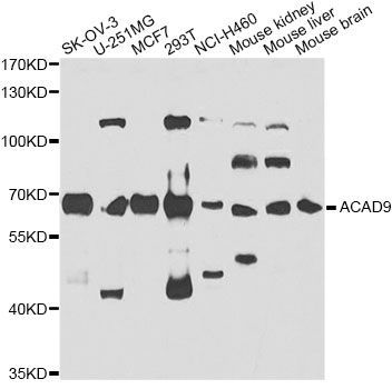 Western blot - ACAD9 antibody (144-07798)