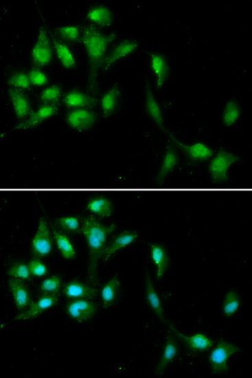Immunofluorescence - HEXIM1 antibody (144-05775)