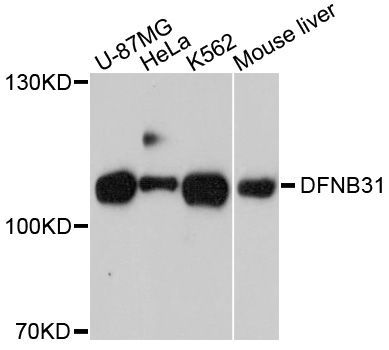 Western blot - WHRN Polyclonal Antibody (144-10773)