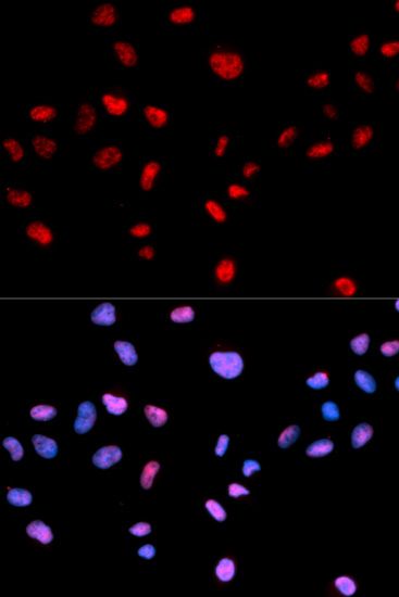 Immunofluorescence - Phospho-CDK1-T161 pAb (144-50324)