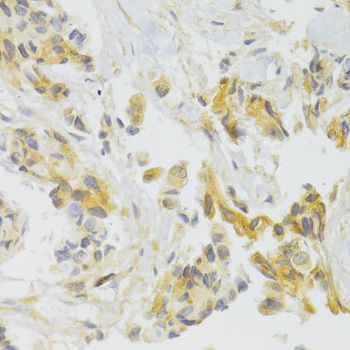 Immunohistochemistry - EIF4G1 Antibody (144-07552)