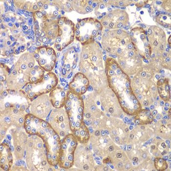 Immunohistochemistry - MMP14 antibody (144-02549)