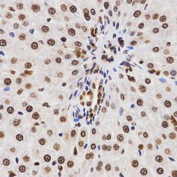 Immunohistochemistry - DiMethyl-Histone H3-K9 antibody (144-02359)