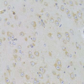 Immunohistochemistry - MAP2K5 Polyclonal Antibody (144-06953)