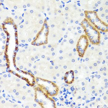 Immunohistochemistry - SYNPO antibody (144-08484)
