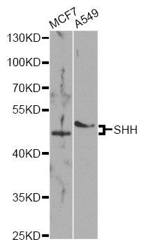 Western blot - SHH antibody (144-07726)
