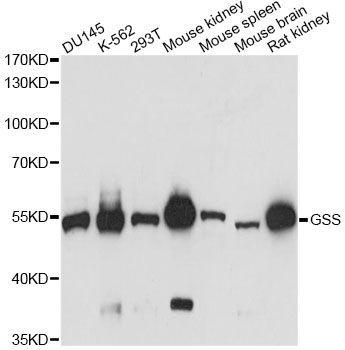 Western blot - [KO Validated] GSS Polyclonal Antibody (144-60698)