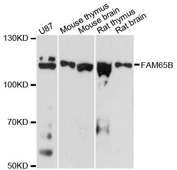 Western blot - FAM65B antibody (144-61469)