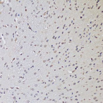 Immunohistochemistry - CTCF Polyclonal Antibody (144-60257)