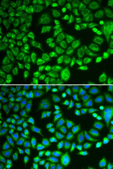 Immunofluorescence - PSMD7 antibody (144-05356)