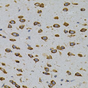 Immunohistochemistry - CAPRIN1 Polyclonal Antibody (144-07910)