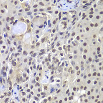 Immunohistochemistry - PRKDC Polyclonal Antibody (144-07716)