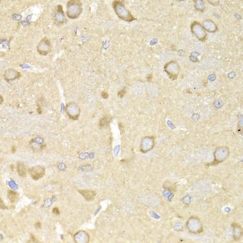 Immunohistochemistry - TRAP1 Antibody (144-02748)