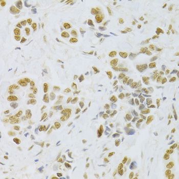 Immunohistochemistry - HMGB1 Polyclonal Antibody (144-02553)