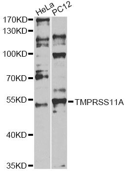 Western blot - TMPRSS11A antibody (144-60592)