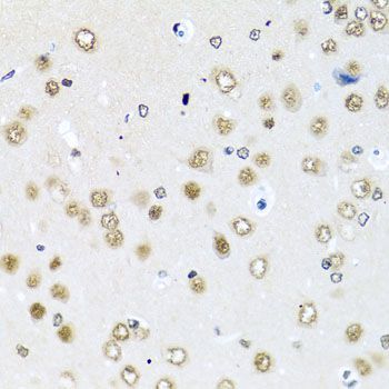 Immunohistochemistry - RAB3IP Polyclonal Antibody (144-08094)