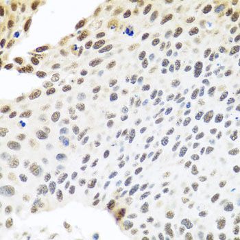 Immunohistochemistry - SKIV2L2 antibody (144-05576)