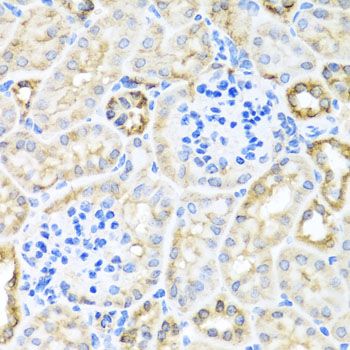 Immunohistochemistry - TIRAP antibody (144-12606)