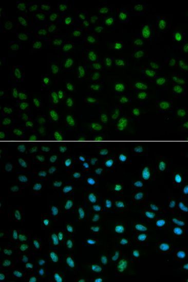 Immunohistochemistry - ELAVL1 Polyclonal Antibody (144-01608)