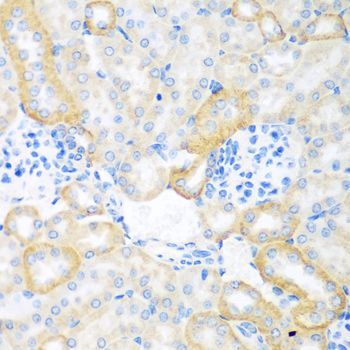 Immunohistochemistry - CEACAM7 antibody (144-08112)