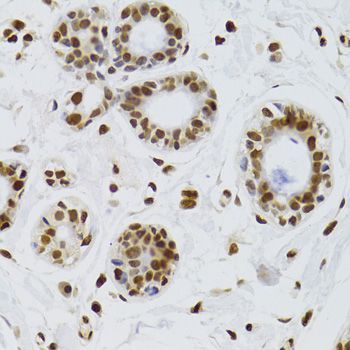 Immunohistochemistry - XRCC6 Polyclonal Antibody (144-00883)