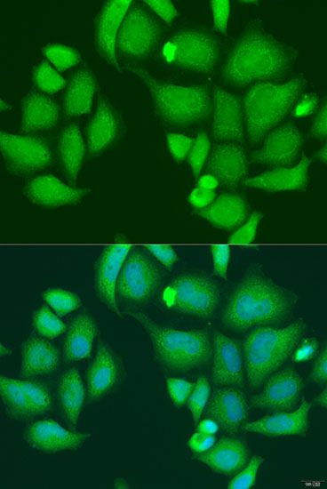 Western blot - [KO Validated] CAPN2 Polyclonal Antibody (144-01861)