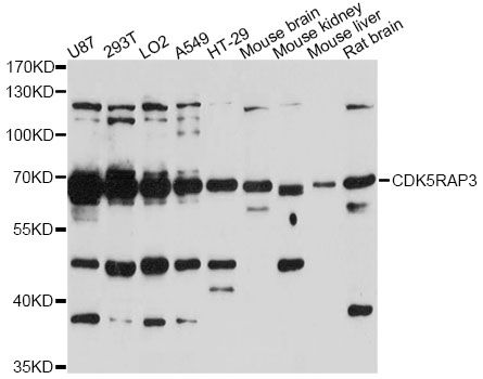 Western blot - CDK5RAP3 antibody (144-61407)