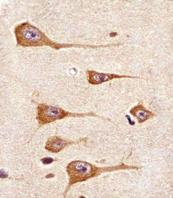 IHC-P