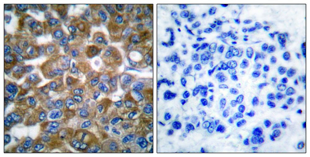 IHC
