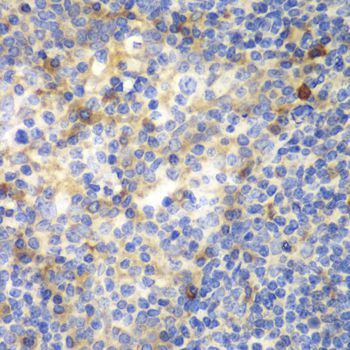 Immunohistochemistry - ZAP70 antibody (144-02195)